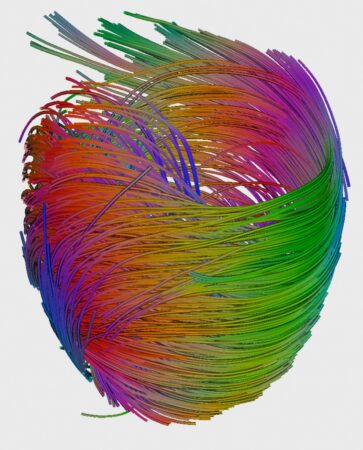 Heartstrings. Credit: University of Oxford, Dr P.Hales/BBSRC