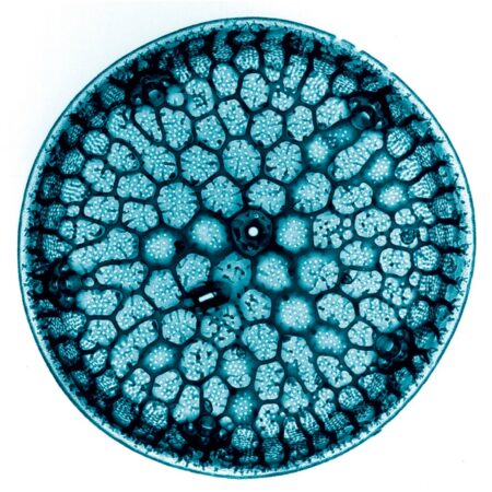 Centric diatom. Kevin Mackenzie, University of Aberdeen.