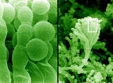 David Gregory & Debbie Marshall. SEM Penicillium mould & spores, close-up.